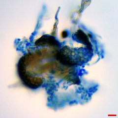 Microsphaeropsis ulmicola