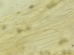 Entoloma cystomarginatum