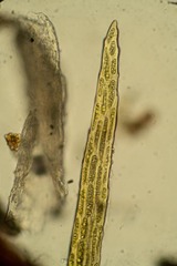 Dicranum elongatum