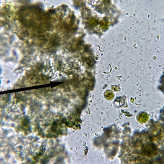 Scoliciosporum umbrinum