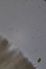 Bryoscyphus dicrani