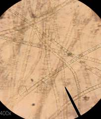 Ulothrix