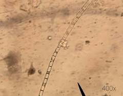Ulothrix
