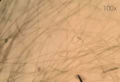 Ulothrix