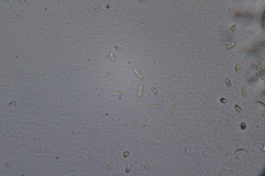 Laetinaevia epithallina