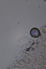 Laetinaevia epithallina