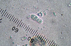 Arthonia indistincta