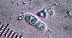 Arthonia indistincta