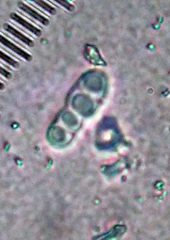 Arthonia indistincta