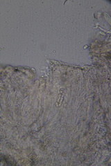 Laetinaevia epithallina