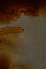 Laetinaevia epithallina