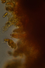 Laetinaevia epithallina