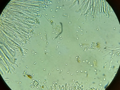 Ciboria amentacea