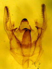 Xanthotype urticaria