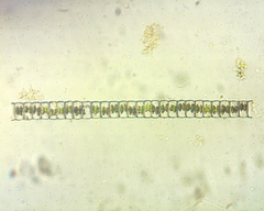 Hyalotheca