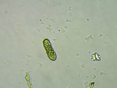 Microcalicium disseminatum