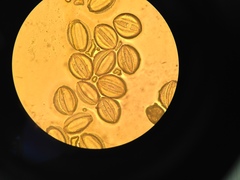 Erythrostemon exostemma