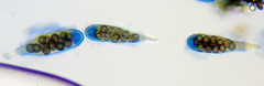 Rinodina pachysperma