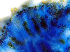 Rinodina pachysperma