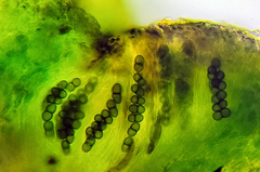 Rinodina pachysperma