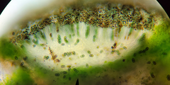 Rinodina pachysperma