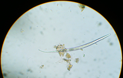 Licmophorales