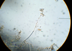 Bacillariophyceae