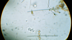 Bacillariophyceae