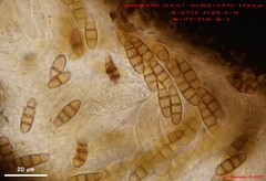 Hysterium angustatum