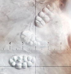 Rhizocarpon reductum