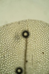 Rhizomnium gracile