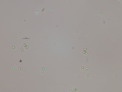 Chaenotheca olivaceorufa