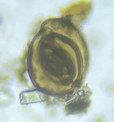 Miliolinella subrotunda