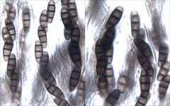 Hysterium angustatum