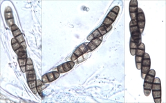 Hysterium angustatum