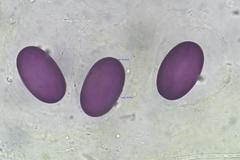 Ascobolus immersus