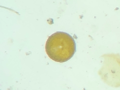 Coscinodiscophycidae