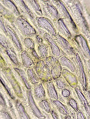 Lewinskya elegans
