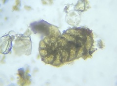 Spiroplectinella wrightii