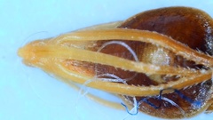 Rhynchospora glomerata angusta