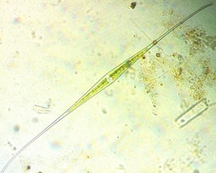 Closterium kuetzingii