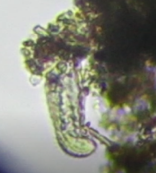 Chaetonotida