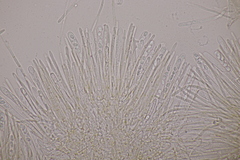 Lachnellula resinaria