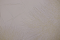 Lachnellula resinaria