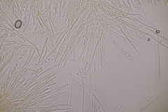 Lachnellula resinaria