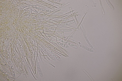 Lachnellula resinaria