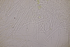 Lachnellula resinaria