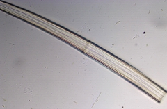 Closterium angustatum