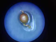 Acaulon