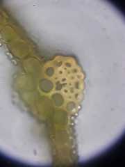 Acaulon